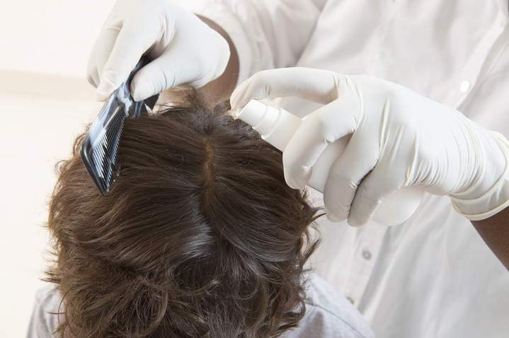 Désinfection cheveux Châteauneuf-Sur-Isère